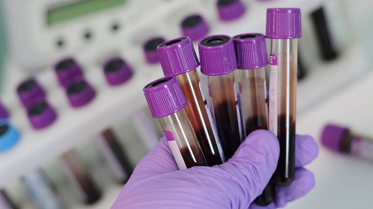 Еще у 25 человек обнаружили коронавирус на Камчатке