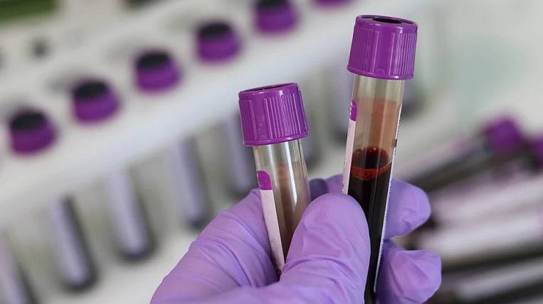Больше 250 случаев коронавируса подтверждено в Забайкалье
